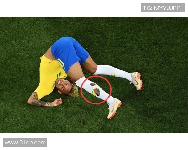 足球明星受伤瞬间高清图片展现运动的残酷与荣耀 足球明星受伤瞬间高清图片展现运动的残酷与荣耀